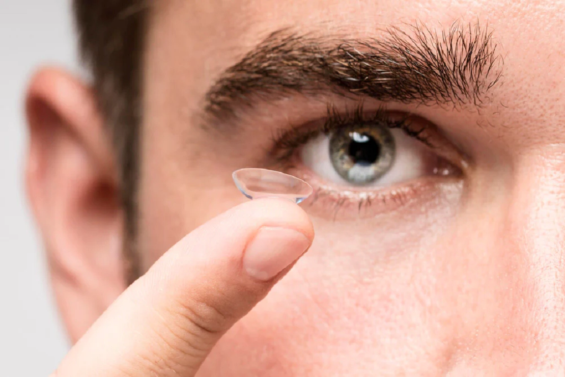 Your Simple Guide to Contact Lenses: Clear Vision Made Easy