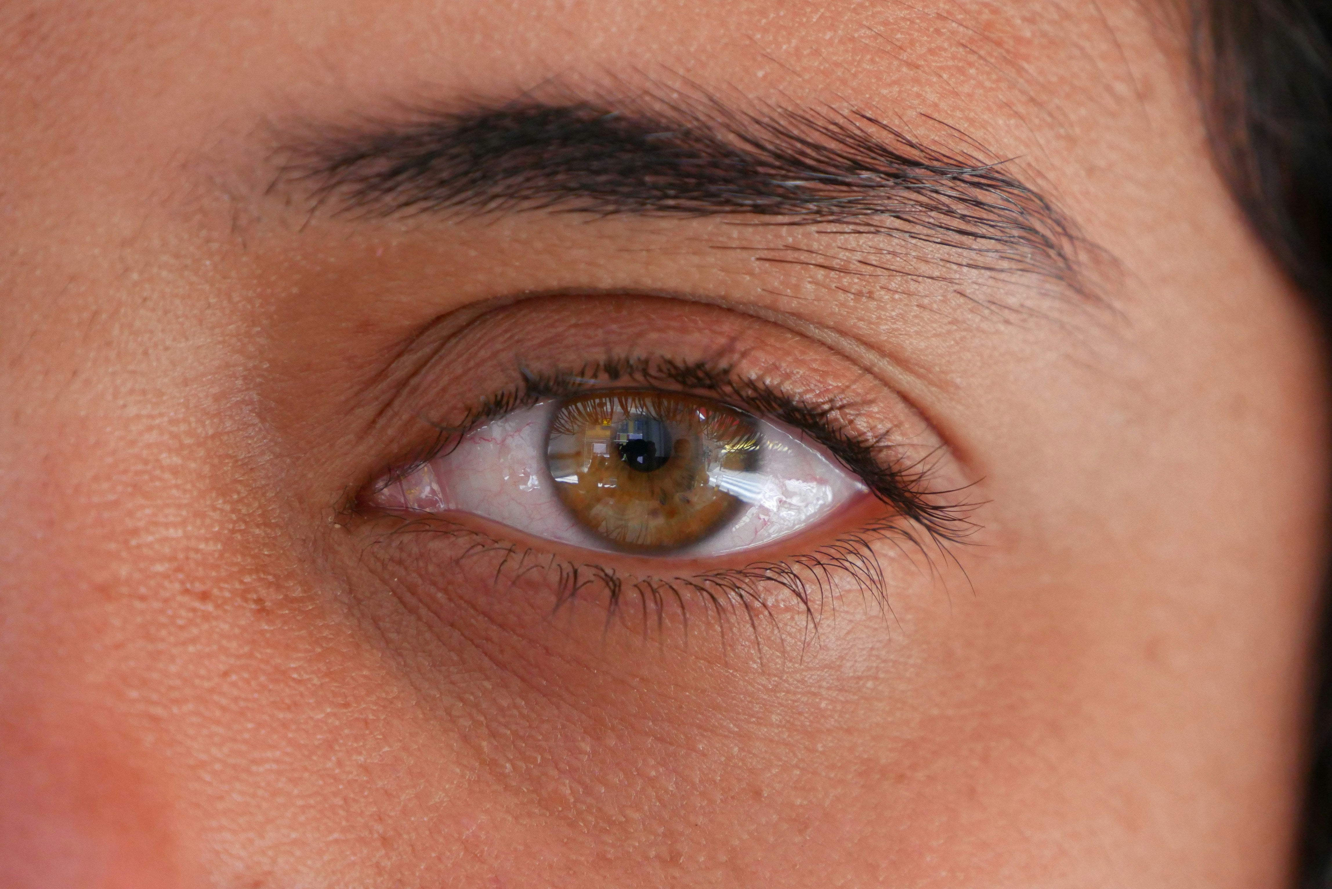 How to Remove Contact Lenses